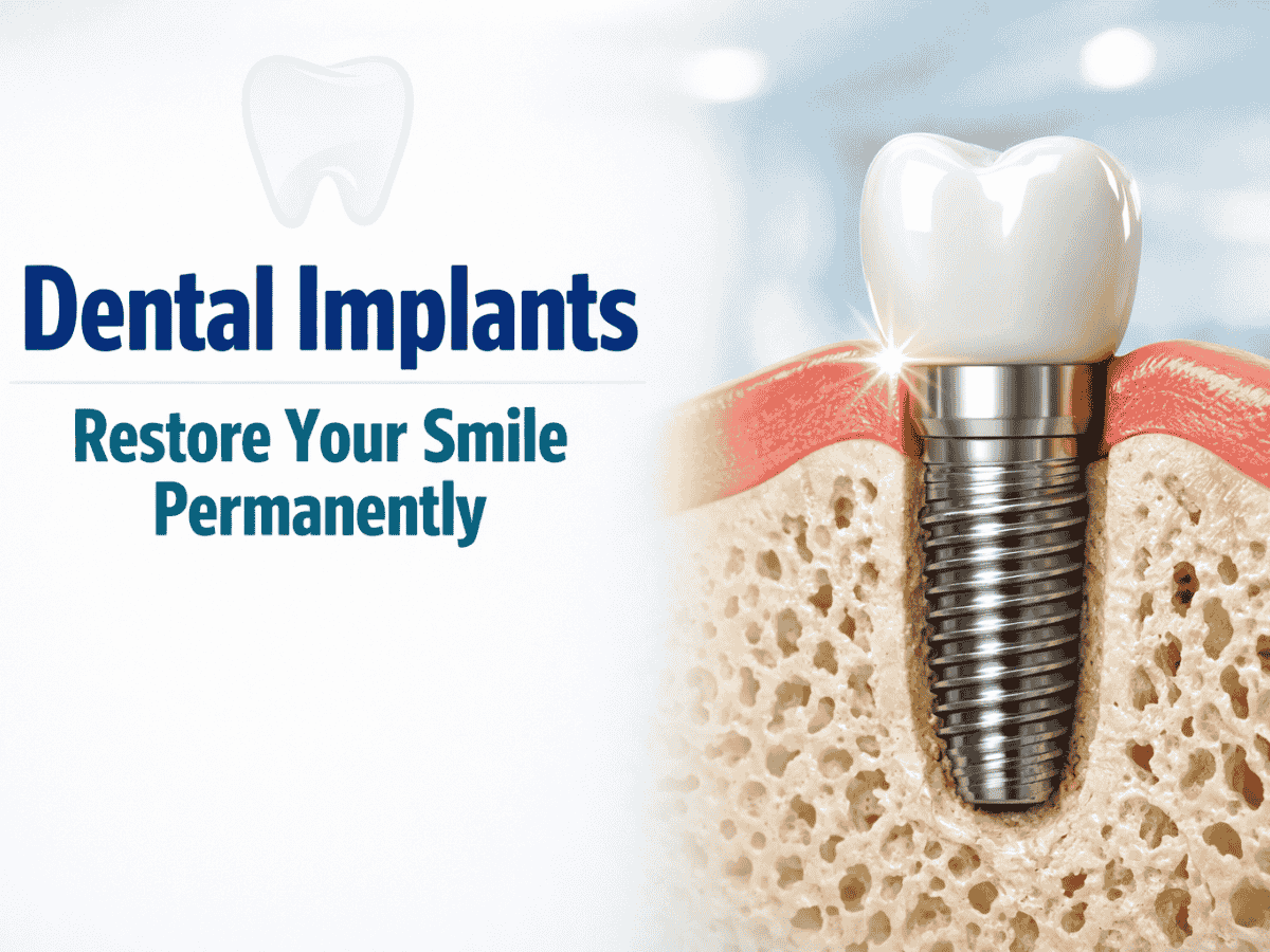 Best Dental Implants in Ambattur – Mithun’s Dental Clinic for Permanent Teeth ₹25,000